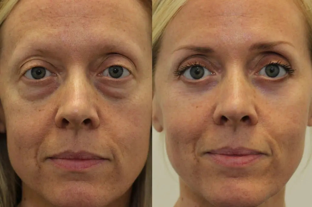Massage 4 en 1 des yeux et du visage.