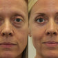 Massage 4 en 1 des yeux et du visage.